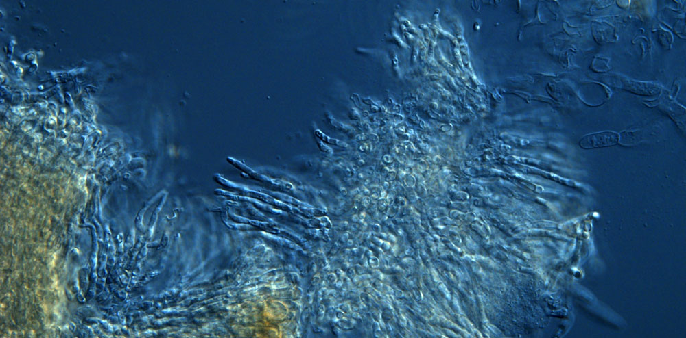 S. macropora |  Photo: Aurora Storlazzi (CNR-IBBR Naples)